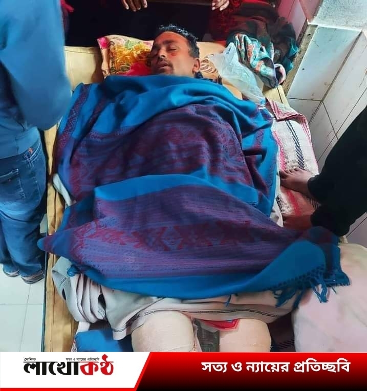 কুষ্টিয়ায় প্রতিপক্ষের গুলিতে আহত সেই নৌকার সমর্থকের মৃত্যু