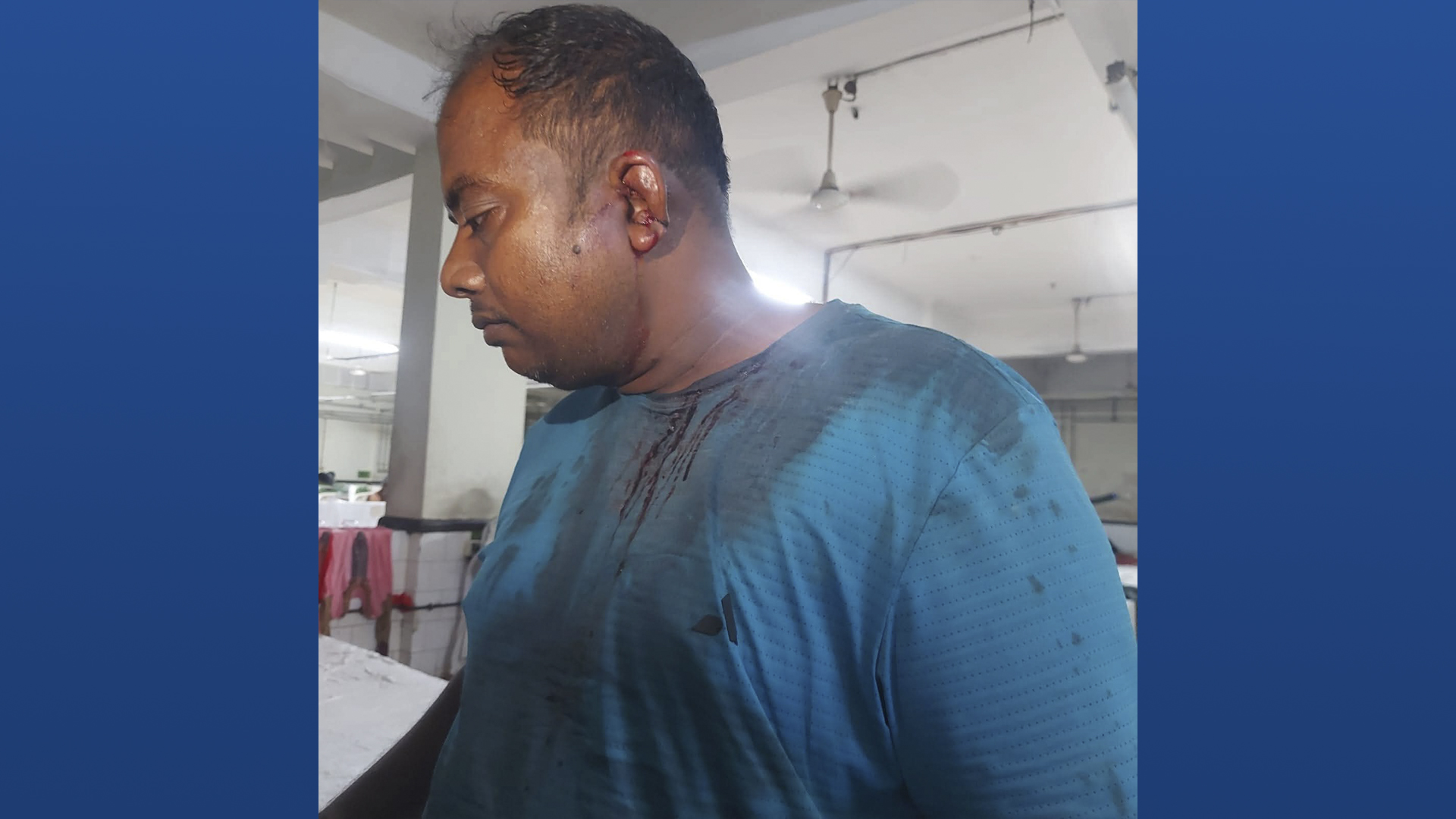 ফেনীর ফরহাদনগরে চাঁদা না দেয়ায় কাতার প্রবাসীকে বেধড়ক মারধর